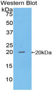 Polyclonal Antibody to Non Metastatic Cells 1, Protein NM23A Expressed In (NME1)