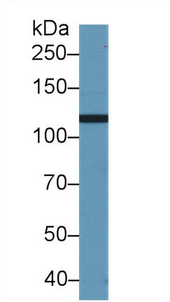 Polyclonal Antibody to Phosphoinositide-3-Kinase Catalytic Beta Polypeptide (PIK3Cb)