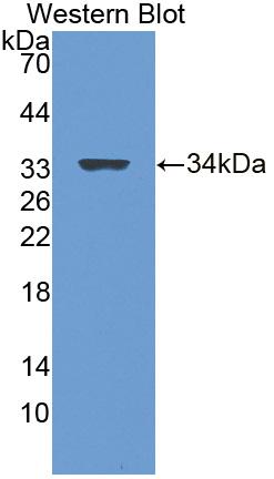 Polyclonal Antibody to Leucine Rich Repeat LGI Family, Member 3 (LGI3)