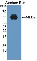 Polyclonal Antibody to A Disintegrin And Metalloproteinase With Thrombospondin 10 (ADAMTS10)