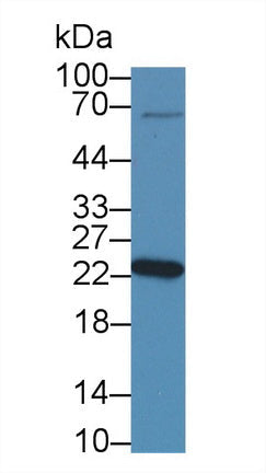 Polyclonal Antibody to Non Metastatic Cells 5, Protein NM23A Expressed In (NME5)