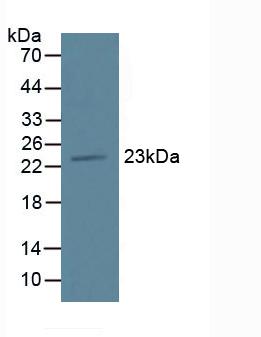 Polyclonal Antibody to Transmembrane Protein 27 (TMEM27)