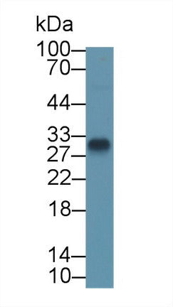Polyclonal Antibody to Transmembrane Protein 27 (TMEM27)