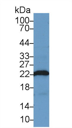 Polyclonal Antibody to Parkinson Disease Protein 7 (PARK7)