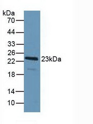 Polyclonal Antibody to Programmed Cell Death Protein 6 (PDCD6)