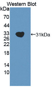 Polyclonal Antibody to GRB2 Associated Binding Protein 2 (GAB2)