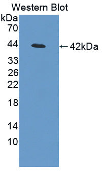 Polyclonal Antibody to Insulin Like Growth Factor 2 mRNA Binding Protein 3 (IGF2BP3)