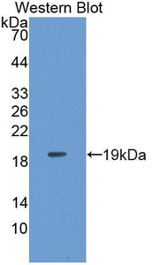 Polyclonal Antibody to Inositol Polyphosphate-4-Phosphatase Type I 107kDa (INPP4A)