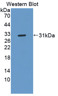 Polyclonal Antibody to Beta-1,3-N-Acetylglucosaminyltransferase Manic Fringe (MFNG)