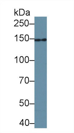 Polyclonal Antibody to Uveal Autoantigen With Coiled Coil Domains And Ankyrin Repeats (UACA)