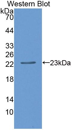 Polyclonal Antibody to CD27 Binding Protein (CD27BP)