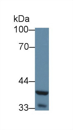 Polyclonal Antibody to Wingless Type MMTV Integration Site Family, Member 5A (WNT5A)