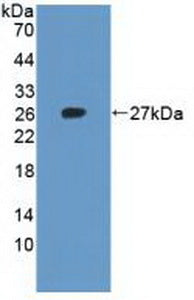 Polyclonal Antibody to Ribosomal Protein L23A (RPL23A)