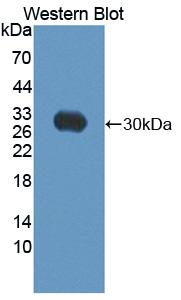 Polyclonal Antibody to ATP Binding Cassette Transporter C10 (C10)