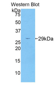 Polyclonal Antibody to A Disintegrin And Metalloprotease 6 (ADAM6)