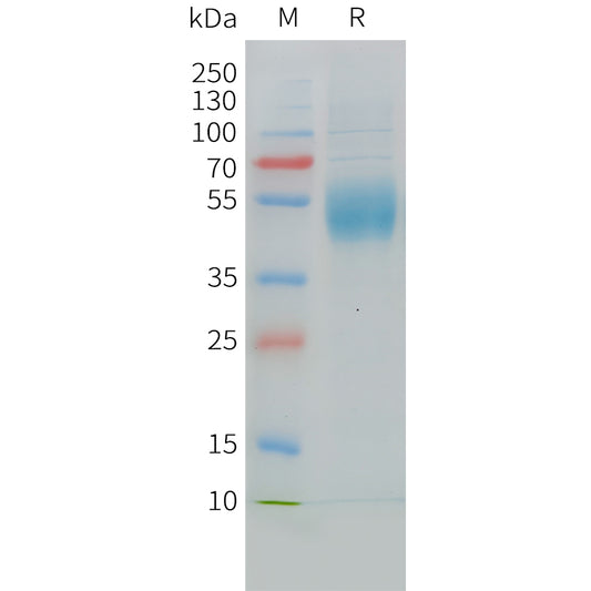 Cynomolgus MICA Protein, His Tag