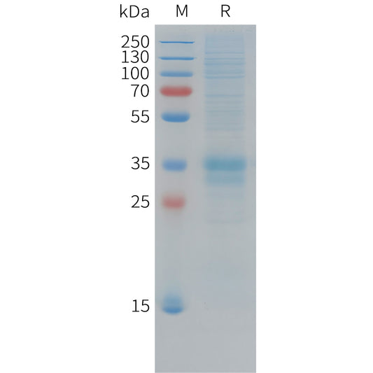 Cynomolgus FOLR1 Protein, His Tag