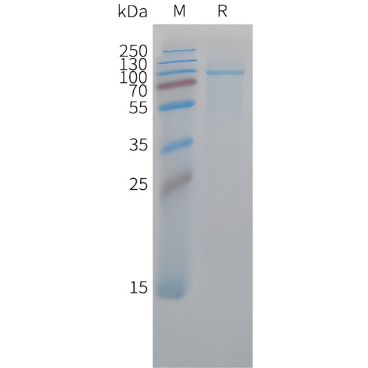 Cynomolgus FAP Protein, His Tag