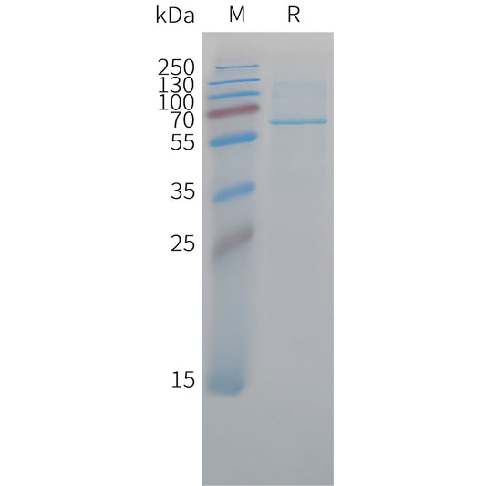 Cynomolgus CD73 Protein, His Tag