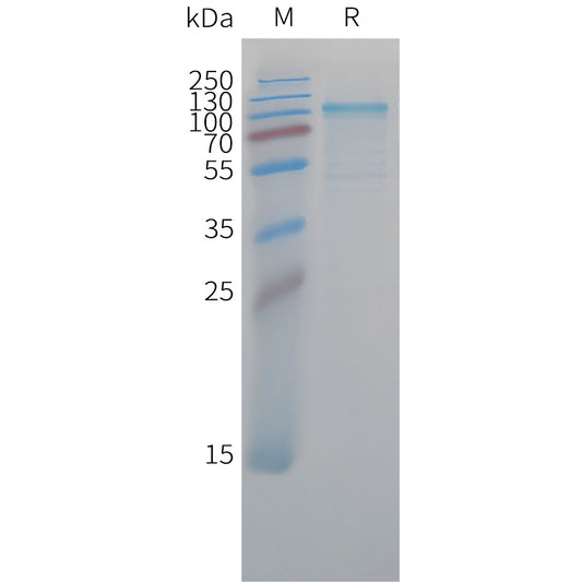 Cynomolgus CDH6 Protein, His Tag