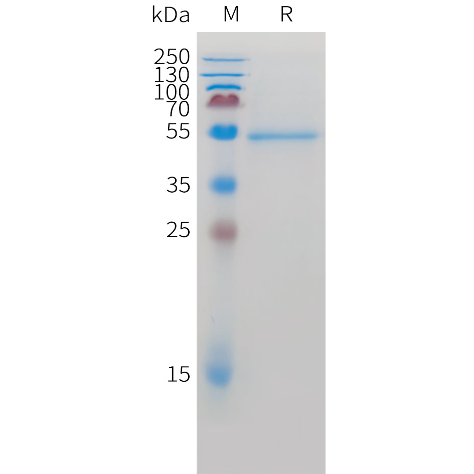 Cynomolgus ROR2 Protein, C-His Tag