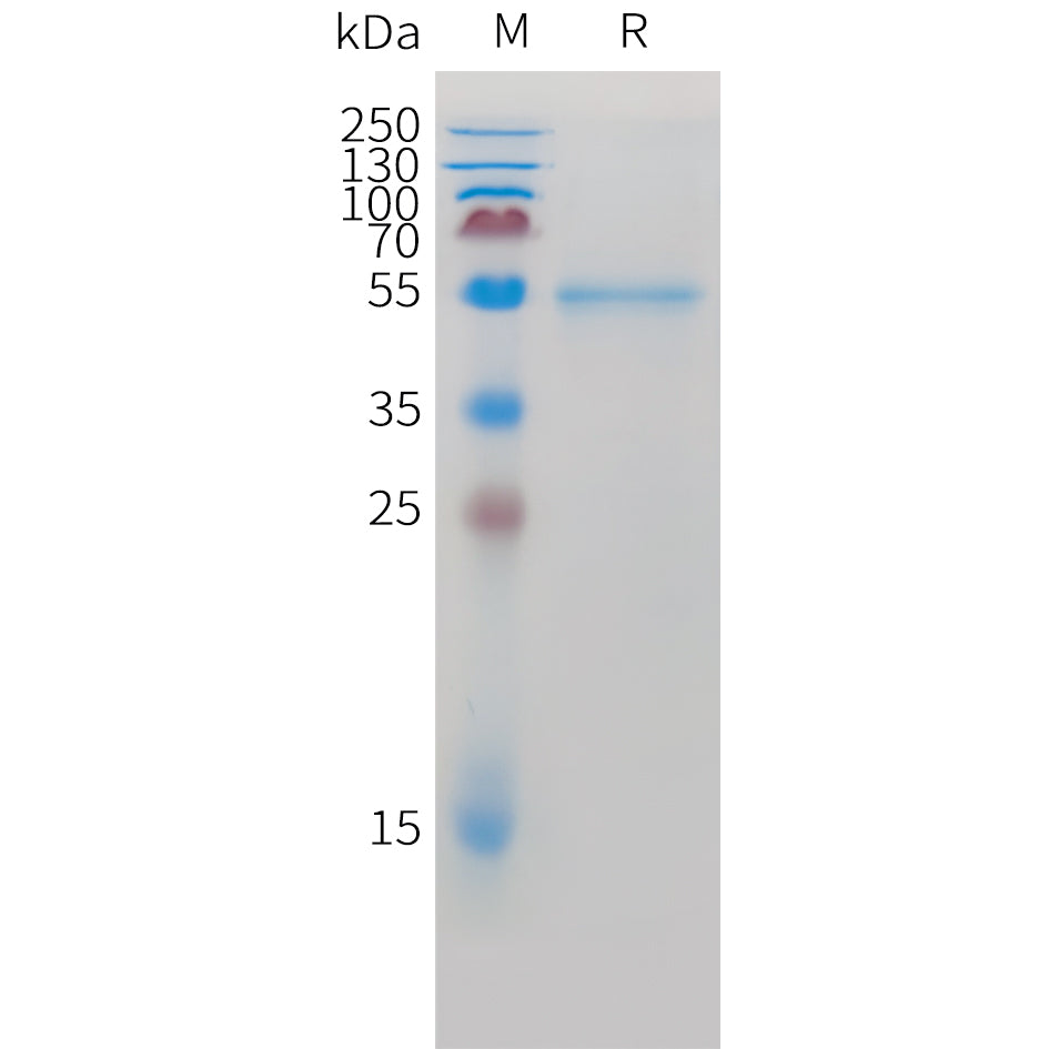 Cynomolgus ROR2 Protein, N-His Tag