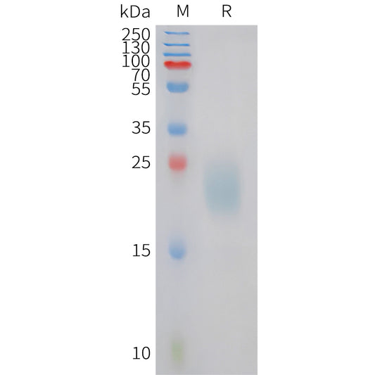 Canine IL31 Protein, His Tag