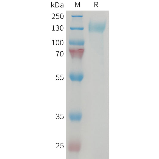 Human CGRPR and RAMP1 Heterodimer Protein, hFc Tag and mFc Tag