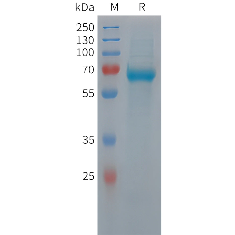 Human C9 Protein, His Tag