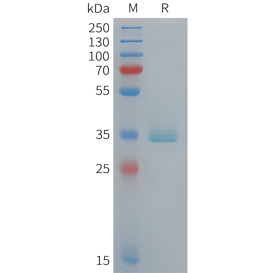 Human APOE Protein, His Tag