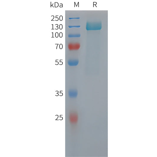 Human MAPT Protein, His Tag