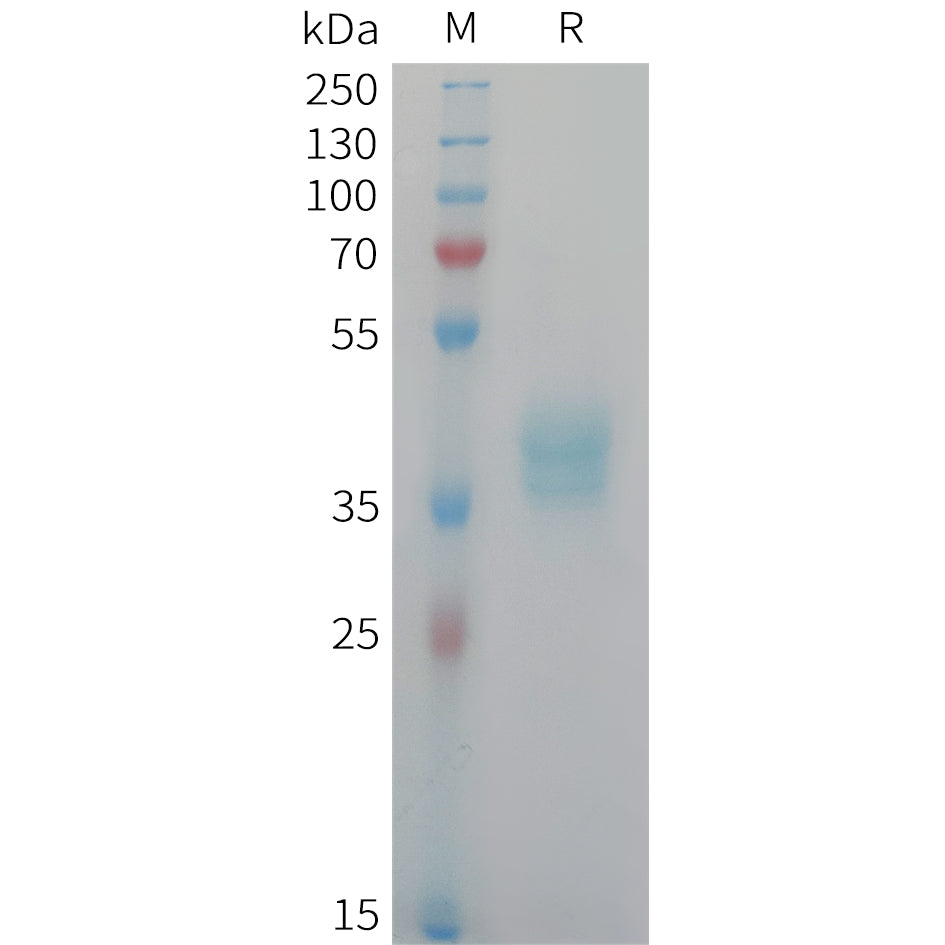 Human CADM3 Protein, His Tag