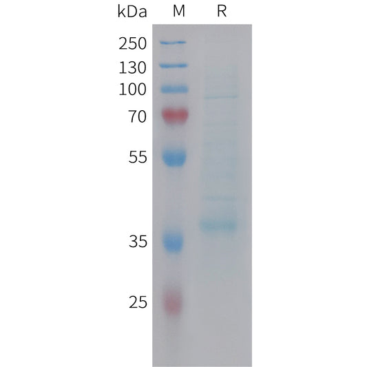 Human CCL19 Protein, hFc Tag