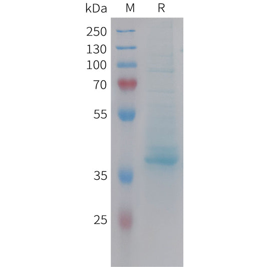 Human CXCL14 Protein, hFc Tag