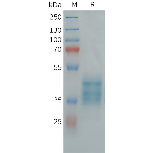 Human GPR84 Protein, hFc Tag