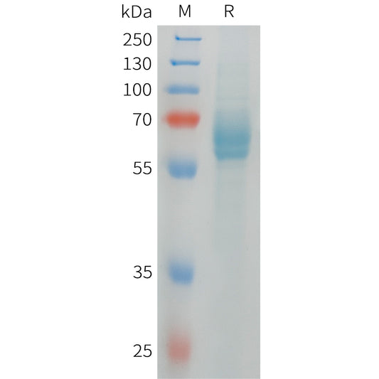 Human DLL4 Protein, His Tag