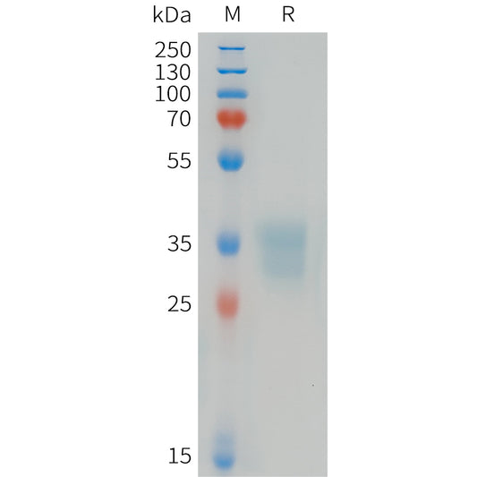 Human EFNB1 Protein, His Tag